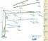 Potain HD 40 A
